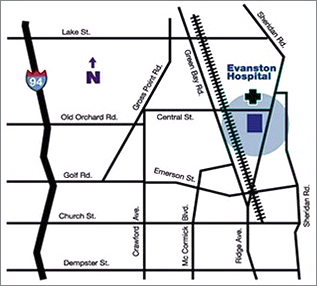 Evanston map
