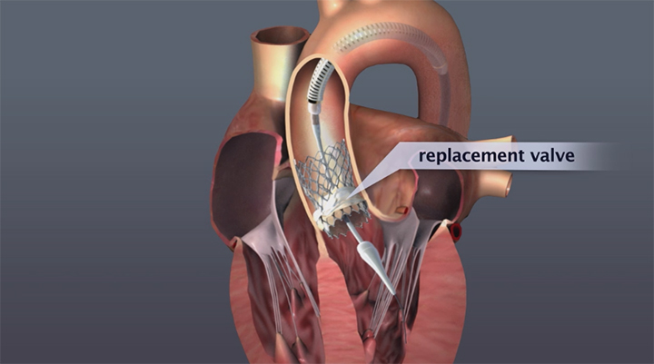 Cardiology Rehabilitation Program