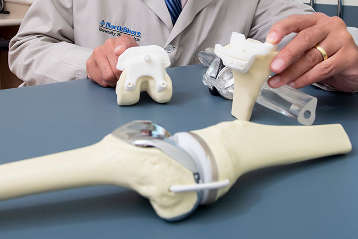 Doctor with joint replacement models