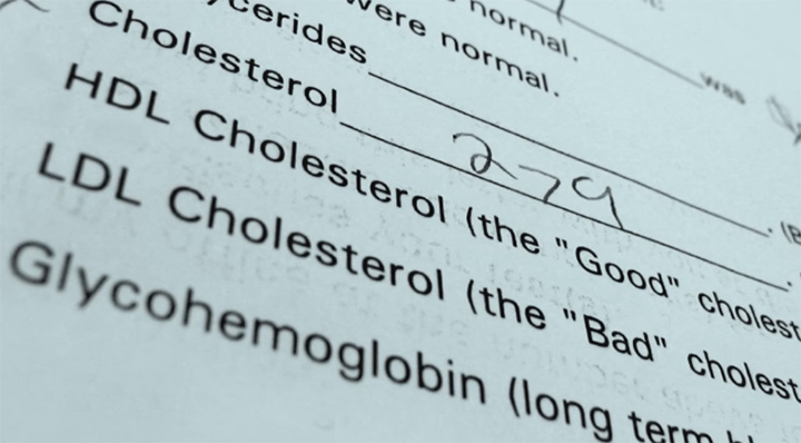 atrial fibrillation