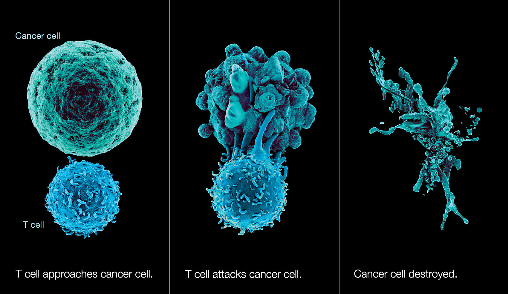 T cell destroying a cancer cell
