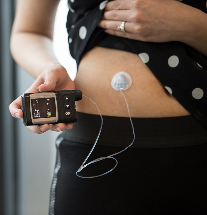 insulin pump